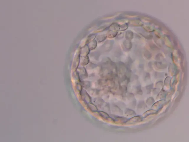 why-did-my-good-quality-embryo-not-implant